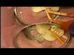 SANI TREATMENT Kasus